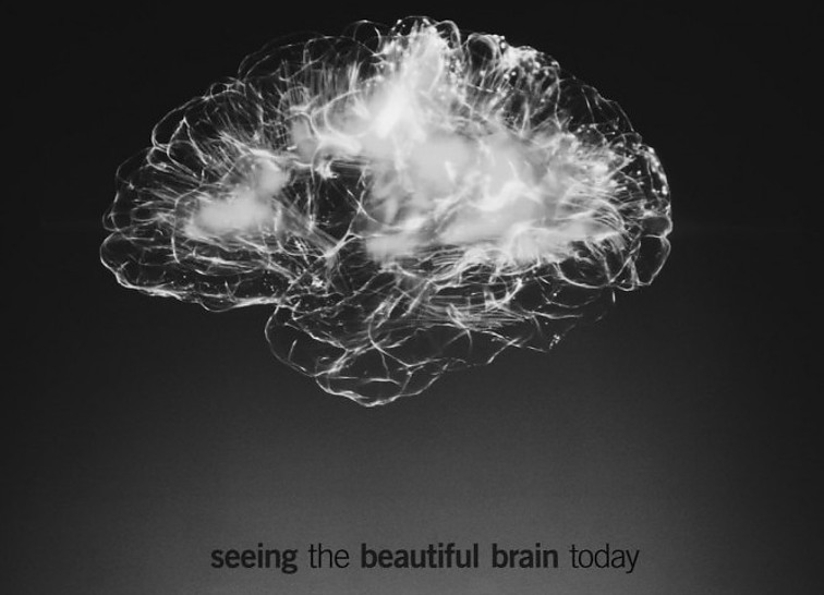 Seeing the beautiful brain today